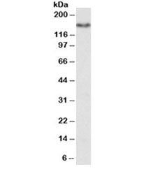 Western blot testing of human kidney lysate with CD13 antibody at 1ug/ml. Predicted molecular weight