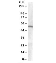 Western blot testing of human duodenum lysate with GCNT3 antibody at 0.1ug/ml. Predicted molecular w