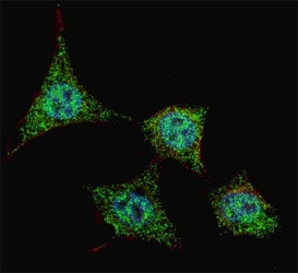Fluorescent confocal image of HeLa cells stained with phospho-Bad antibody at 1:200. Note the highly