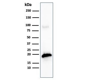 MART-1 / Melan-A Antibody