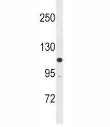 MLCK Antibody