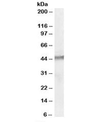 Western blot testing of human testis lysate with STK35 antibody at 1ug/ml. Predicted molecular weigh