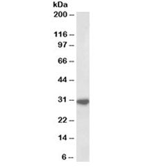 Western blot testing of human peripheral blood lymphocyte lysate with IL-1 beta antibody at 1ug/ml. 