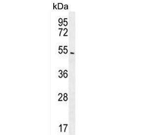 Western blot testing of human A549 cell lysate with ARRB1 antibody. Predicted molecular weight ~47 k