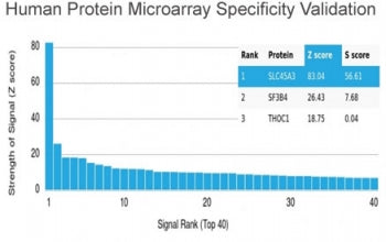 Analysis of HuProt(TM) microarray containing more than 19,000 full-length human proteins using recom