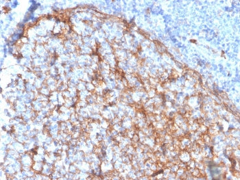 IHC staining of FFPE human tonsil with CD11b antibody (clone ITGAM/3337). HIER: boil tissue sections