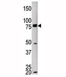 MELK Antibody