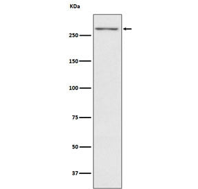 Western blot testing with TG antibody. Predicted molecular weight ~305 kDa.