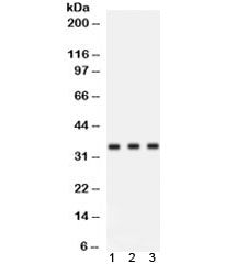 Cyclin D1 Antibody