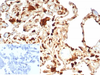 IHC staining of FFPE human lung tissue with S100A11 antibody (clone S100A11/7392). Inset: PBS used i