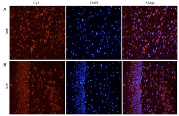 IHC staining of FFPE rat cerebral cortex [A] and rat hippocampus [B] with CHRNA antibody at 5ug/ml; 