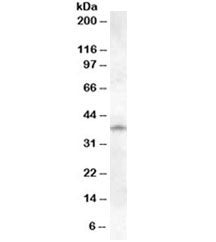Western blot testing of human lung lysate with Cathepsin K antibody at 1ug/ml. Predicted molecular w