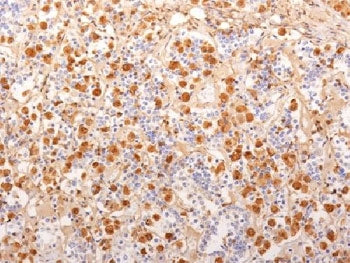 Synacthen Antibody / ACTH