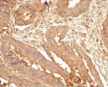 Galectin 3 Antibody