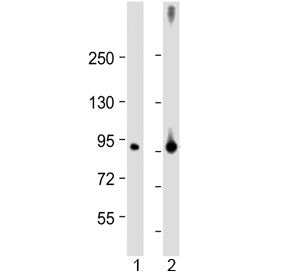 Western blot testing of human 1) lung and 2) placenta lysate with Factor XIIIa antibody at 1:2000. P