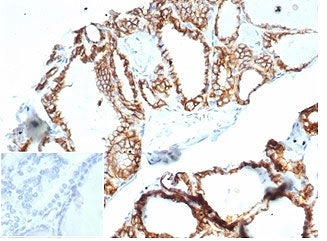 Recombinant CDH16 Antibody / Cadherin 16