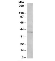 Western blot testing of Jurkat lysate with SAE1 antibody at 1ug/ml. Predicted/observed molecular wei