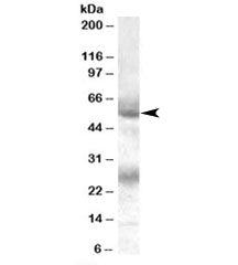 Western blot testing of human bone marrow lysate with FLVCR antibody at 0.1ug/ml. The expected ~55kD