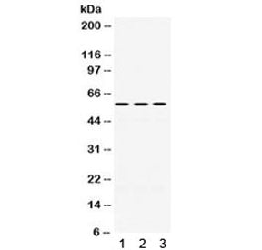 ERp57 Antibody / PDIA3