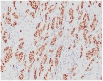 Estrogen Receptor alpha Antibody