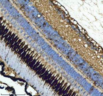 IHC staining of zebrafish Gnrh2 protein using Zebrafish Gnrh2 antibody, HRP-labeled secondary and DA