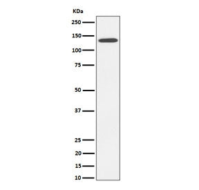 Western blot testing of human HepG2 cell lysate with CDH4 antibody. Expected molecular weight: 100-1