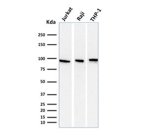 Western blot testing of human 1) Jurkat, 2) Raji and 3) ThP-1 cell lysate with Transferrin receptor 