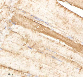IHC staining of FFPE zebrafish muscle tissue with Psmb1 antibody, HRP-labeled secondary and DAB subs
