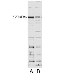 Western blot testing of HFF cell lysate and A) control siRNA or B) 100nM siRNA with SECISBP2 antibod