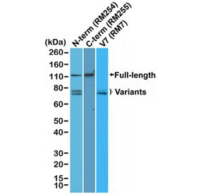 Western blot testing of human 22RV1 cell lysate with Androgen Receptor antibody: cat no. R20274, cat no. R20341 and cat no. R20481, respectively.