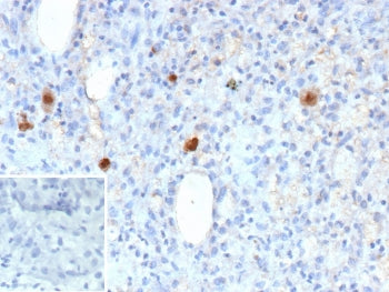 IHC staining of FFPE human CMV-infected tissue with Cytomegalovirus antibody (clone rCMV/9827). Inse