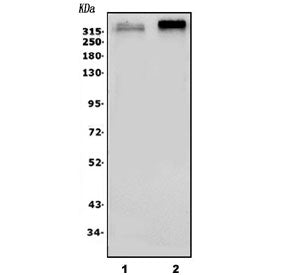Western blot testing of 1) rat brain and 2) mouse brain lysate with Scn2a antibody. Predicted molecu