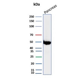 Western blot testing of human pancreas tissue lysate with PNLIP antibody. Predicted molecular weight