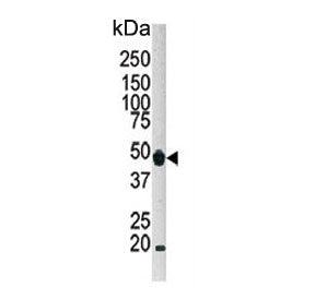 Western blot testing of human HeLa cell lysate with ATG4B antibody. Expected molecular weight: 37-52
