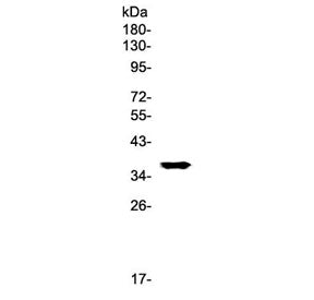 Western blot testing of rat liver lysate with GALE antibody at 0.5ug/ml. Predicted molecular weight 