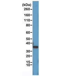 Western blot testing of human HeLa cell lysate with recombinant Cyclin D1 antibody at 1:1000. Predic