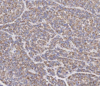 MAD2L2 Antibody / MAD2B / REV7