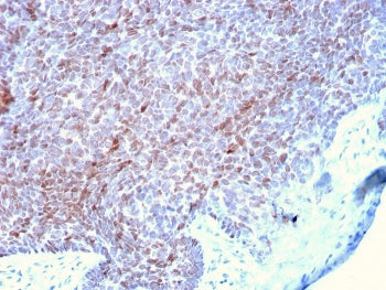 IHC staining of FFPE human skin with p73 antibody. HIER: boil tissue sections in pH 9 10mM Tris with