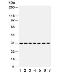 Western blot testing of 1) rat liver, 2) rat lung, 3) human HeLa, 4) A549, 5) MM231, 6) SW620 and 7)