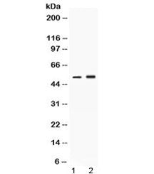 Alpha 1 Antitrypsin Antibody / AAT / SERPINA1