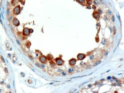 IHC testing of FFPE human testis with ALMS1 antibody at 2ug/ml. Microwaved antigen retrieval with Tr