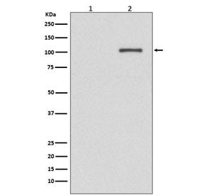 Western blot testing of lysate from 1) untreated and 2) AP-treated human K562 cells with phospho-IRE