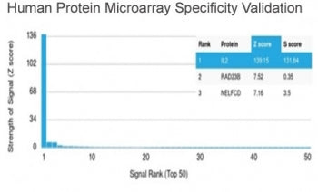 Analysis of HuProt(TM) microarray containing more than 19,000 full-length human proteins using IL-2 