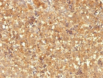 Alpha Fetoprotein / AFP Antibody