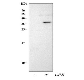 Interleukin-1 beta Antibody / IL-1 beta