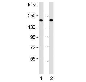 Western blot testing of human 1) lung and 2) plasma lysate with Complement factor H antibody. Predic