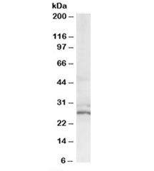 Western blot testing of HeLa lysate with TIP30 antibody at 0.6ug/ml. Predicted molecular weight: ~27