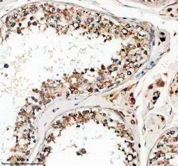Phospho-LIPE (pSer853) Antibody / Hormone-sensitive lipase / HSL, 100ul