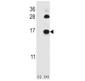 Western blot analysis of FABP4 antibody and 293 cell lysate (2 ug/lane) either nontransfected (Lane 