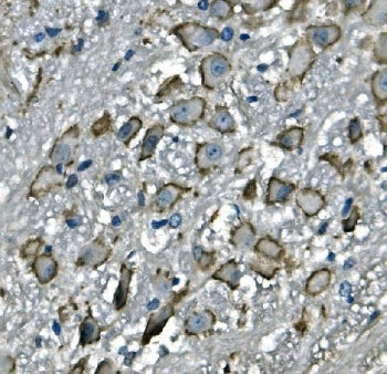IHC staining of FFPE mouse brain with Cd97 antibody. HIER: boil tissue sections in pH8 EDTA for 20 m